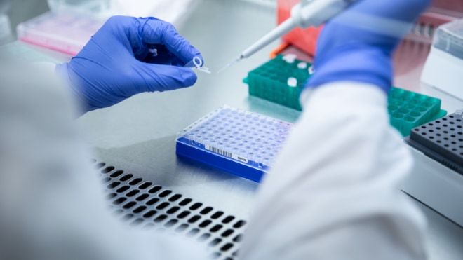 A lab worker uses a pipette to fill samples.